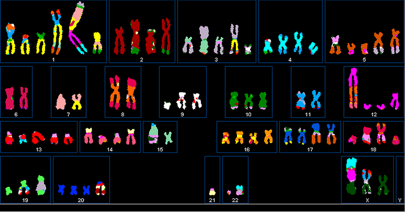 显示新形成的染色体的乳腺癌细胞，染色与原始染色体颜色匹配。